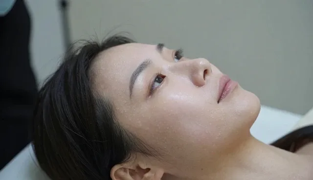 术前沟通对玻尿酸填充效果的关键影响